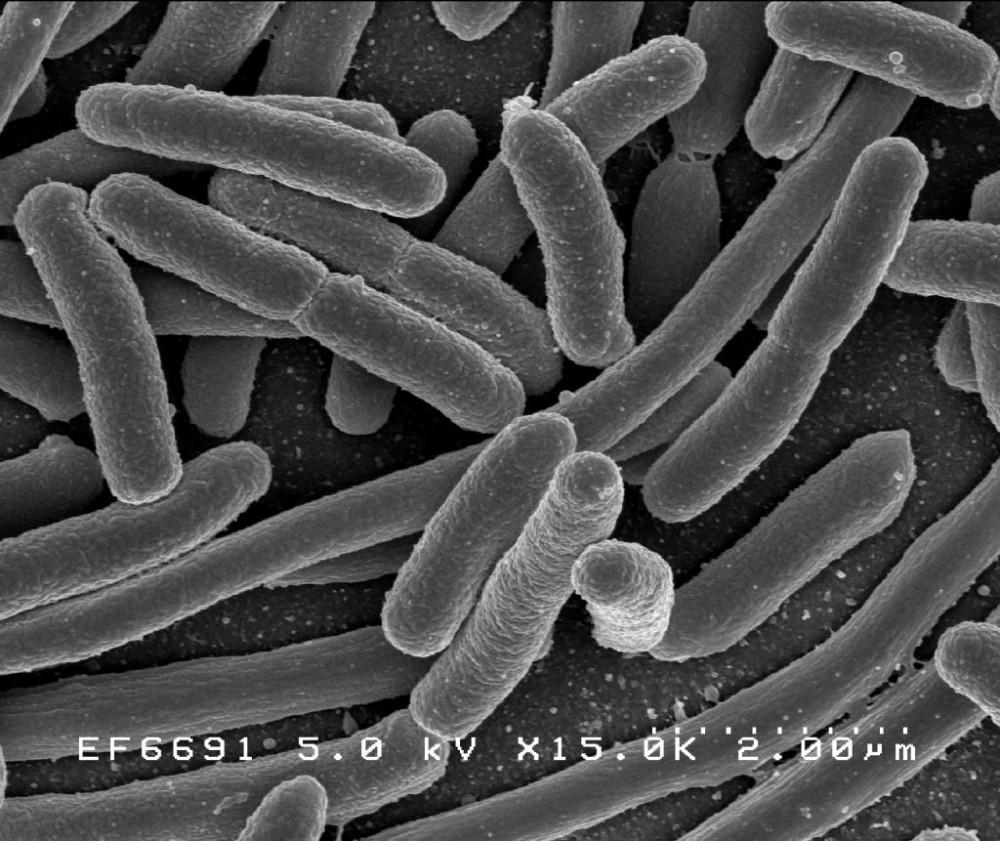 syntetyczne-dna-kodony-bakteria-escherichia-coli class="wp-image-939845" 